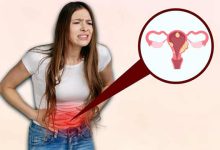 بیماری فیبروم