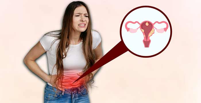 بیماری زنان بیماری فیبروم